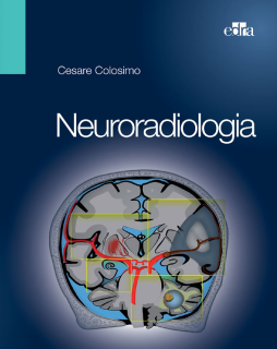 Neuroradiologia Neuroradiologia