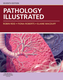 Pathology Illustrated E-Book Pathology Illustrated E-Book