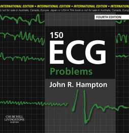 150 ECG Problems E-Book 150 ECG Problems E-Book
