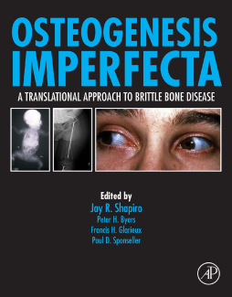 Osteogenesis Imperfecta Osteogenesis Imperfecta
