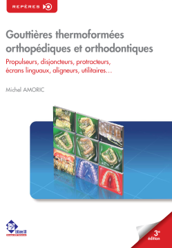 Gouttières thermoformées orthopédiques & orthodontiques Gouttières thermoformées orthopédiques & orthodontiques