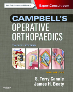 Campbell's Operative Orthopaedics E-Book Campbell's Operative Orthopaedics E-Book