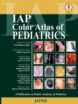 IAP Color Atlas of Pediatrics (A Publication of Indian Academy of Pediatrics) IAP Color Atlas of Pediatrics (A Publication of Indian Academy of Pediatrics)