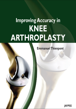 Improving Accuracy in Knee Arthroplasty Improving Accuracy in Knee Arthroplasty
