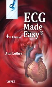 ECG Made Easy® ECG Made Easy®