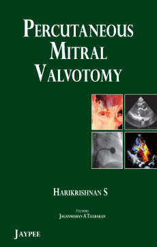 Percutaneous Mitral Valvotomy Percutaneous Mitral Valvotomy
