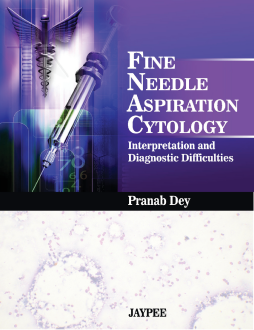 Fine Needle Aspiration Cytology: Interpretation and Diagnostic Difficulties Fine Needle Aspiration Cytology: Interpretation and Diagnostic Difficulties