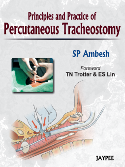 Principles and Practice of Percutaneous Tracheostomy