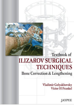 Textbook of Ilizarov Surgical Techniques: Bone Correction and Lengthening 