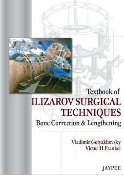 Textbook of Ilizarov Surgical Techniques: Bone Correction and Lengthening Textbook of Ilizarov Surgical Techniques: Bone Correction and Lengthening