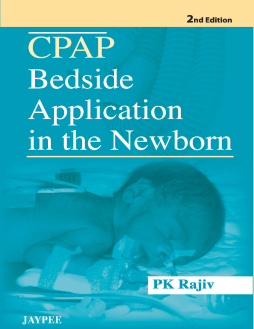 CPAP (Continuous Positive Airway pressure) Bedside Application in the Newborn CPAP (Continuous Positive Airway pressure) Bedside Application in the Newborn