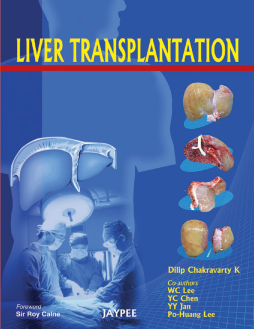 Liver Transplantation Liver Transplantation