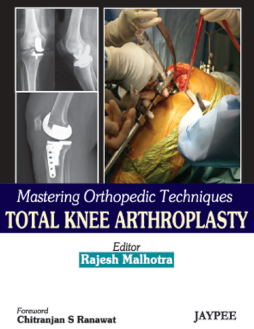 Mastering Orthopedic Techniques Total Knee Arthroplasty Mastering Orthopedic Techniques Total Knee Arthroplasty