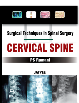 Surgical Techniques in Spinal Surgery: Cervical Spine: A Step by Step Approach