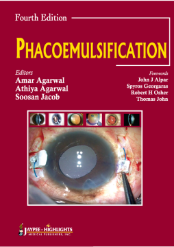Phacoemulsification Phacoemulsification