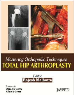 Mastering Orthopedic Techniques Total Hip Arthroplasty