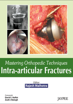 Mastering Orthopedic Techniques: Intra-articular Fractures Mastering Orthopedic Techniques: Intra-articular Fractures