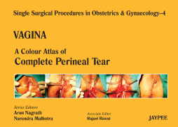 A Colour Atlas of Complete Perineal Tear (Volume 4)