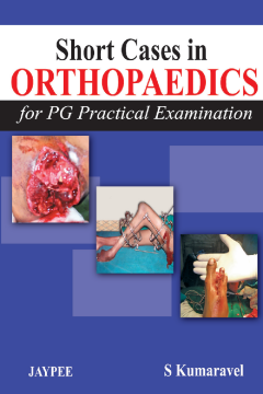 Short Cases in Orthopaedics for PG Practical Examination Short Cases in Orthopaedics for PG Practical Examination