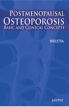 Postmenopausal Osteoporosis: Basic and Clinical Concepts Postmenopausal Osteoporosis: Basic and Clinical Concepts