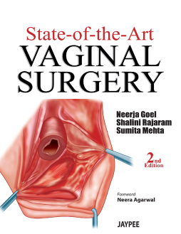 State-of-the-Art: Vaginal Surgery State-of-the-Art: Vaginal Surgery