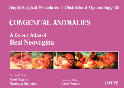 A Colour Atlas of Ileal Neovagina (Volume 33) A Colour Atlas of Ileal Neovagina (Volume 33)