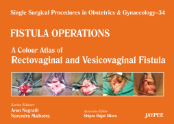 A Colour Atlas of Rectovaginal and Vesicovaginal Fistula (Volume 34)