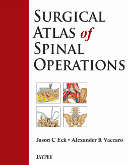 Surgical Atlas of Spinal Operations Surgical Atlas of Spinal Operations