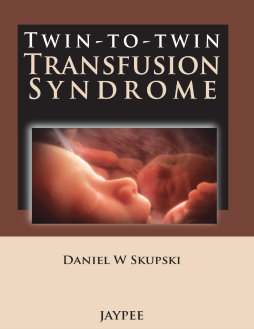 Twin-to-Twin Transfusion Syndrome Twin-to-Twin Transfusion Syndrome