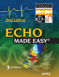 Echo Made Easy® Echo Made Easy®