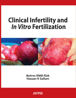 Clinical Infertility and In Vitro Fertilization