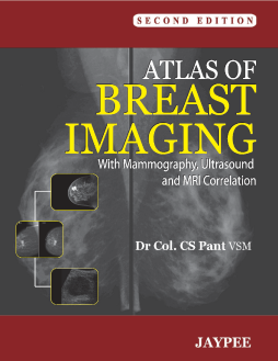 Atlas of Breast Imaging with Mammography, Ultrasound and MRI Correlation Atlas of Breast Imaging with Mammography, Ultrasound and MRI Correlation