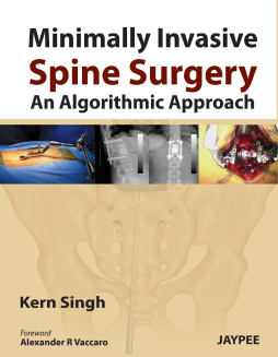 Minimally Invasive Spine Surgery: An Algorithmic Approach Minimally Invasive Spine Surgery: An Algorithmic Approach