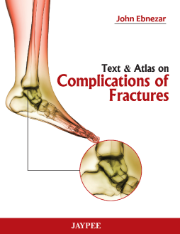 Text and Atlas on Complications of Fractures Text and Atlas on Complications of Fractures