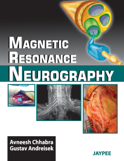 Magnetic Resonance Neurography Magnetic Resonance Neurography
