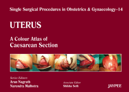 Single Surgical Procedures in Obstetrics and Gynaecology–14: A Colour Atlas of Caesarean Section Single Surgical Procedures in Obstetrics and Gynaecology–14: A Colour Atlas of Caesarean Section