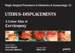 Single Surgical Procedures in Obstetrics and Gynaecology–15: A Colour Atlas of Cervicopexy (Purandare’s) Single Surgical Procedures in Obstetrics and Gynaecology–15: A Colour Atlas of Cervicopexy (Purandare’s)