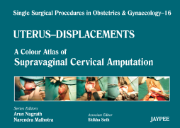 Single Surgical Procedures in Obstetrics and Gynaecology–16: A Colour Atlas of Supravaginal Cervical Amputation (Nadkarni's)