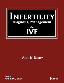 Infertility: Diagnosis, Management and IVF Infertility: Diagnosis, Management and IVF
