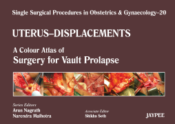 Single Surgical Procedures in Obstetrics and Gynaecology–20: A Colour Atlas of Surgery for Vault Prolapse Single Surgical Procedures in Obstetrics and Gynaecology–20: A Colour Atlas of Surgery for Vault Prolapse