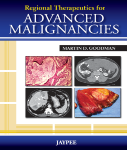 Regional Therapeutics for Advanced Malignancies Regional Therapeutics for Advanced Malignancies