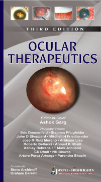 Ocular Therapeutics Ocular Therapeutics