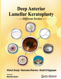 Deep Anterior Lamellar Keratoplasty: Different Strokes Deep Anterior Lamellar Keratoplasty: Different Strokes