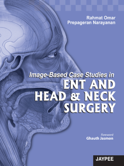 Image-Based Case Studies in ENT and Head and Neck Surgery Image-Based Case Studies in ENT and Head and Neck Surgery