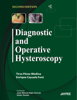 Diagnostic and Operative Hysteroscopy Diagnostic and Operative Hysteroscopy
