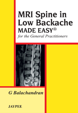MRI Spine in Low Backache Made Easy® for the General Practitioners MRI Spine in Low Backache Made Easy® for the General Practitioners
