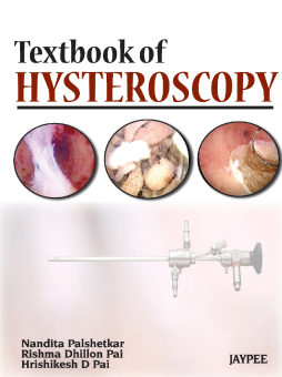 Textbook of Hysteroscopy Textbook of Hysteroscopy