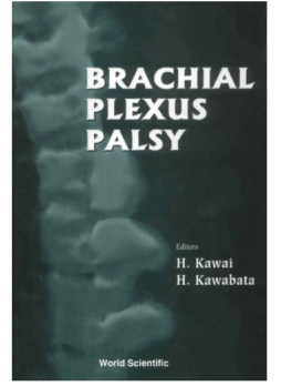 Brachial Plexus Palsy Brachial Plexus Palsy