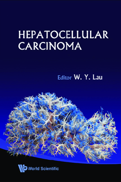 Hepatocellular Carcinoma Hepatocellular Carcinoma