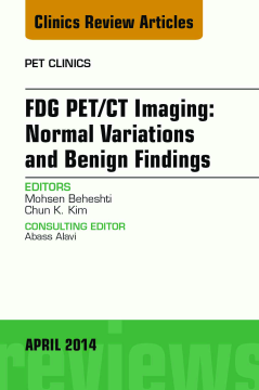 FDG PET/CT Imaging: Normal Variations and Benign Findings – Translation to PET/MRI, An Issue of PET Clinics, E-Book